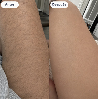 Crema Depilatoria Mirosse