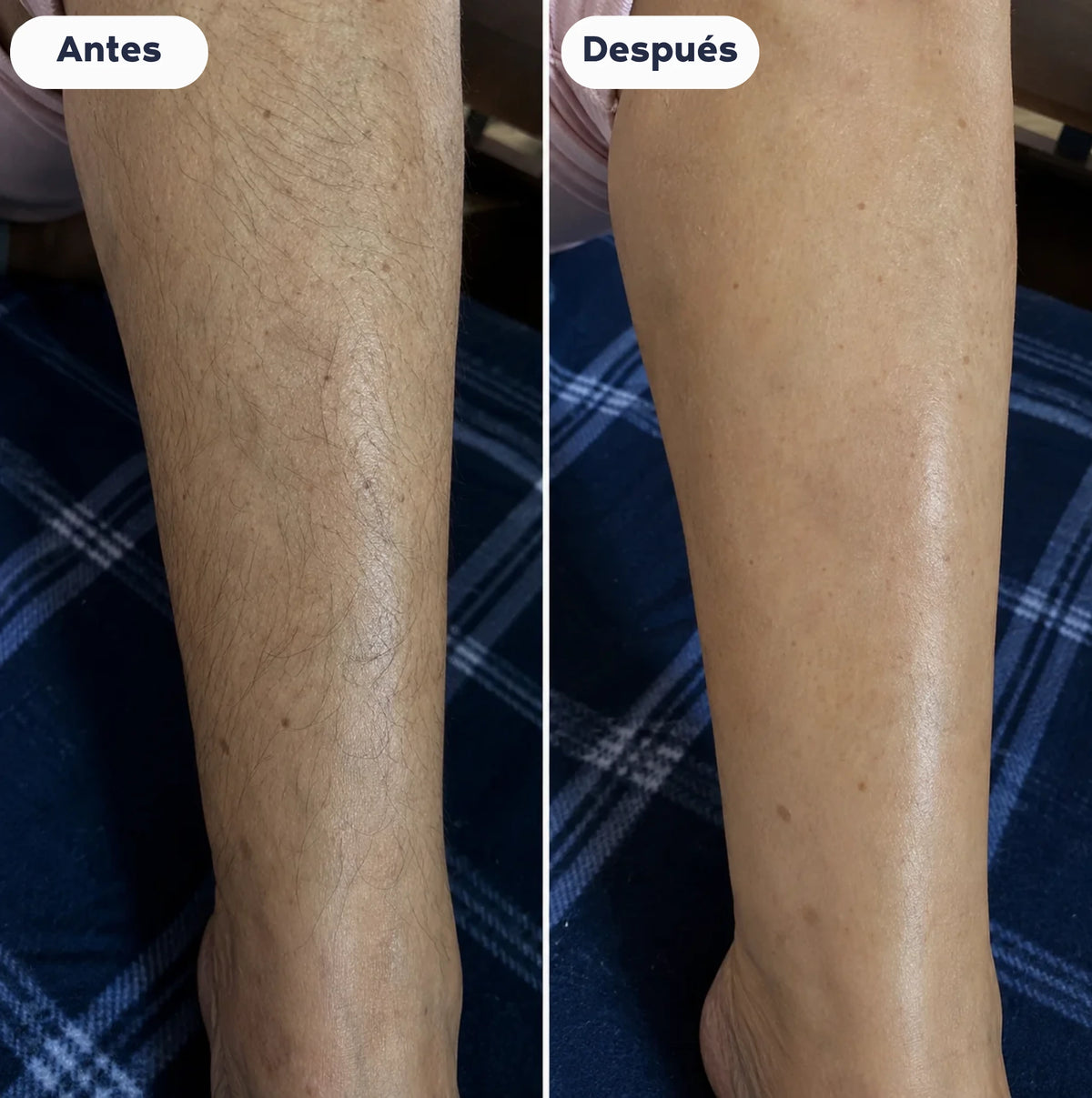 Crema Depilatoria Mirosse